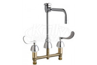 Chicago 786-GN2BVBE3-2ABCP Concealed Hot and Cold Water Sink Faucet